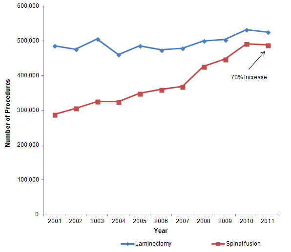 Figure 2 is a line chart illustrating the number of procedures by year for 2 operating room procedures â laminectomy, and spinal fusion.